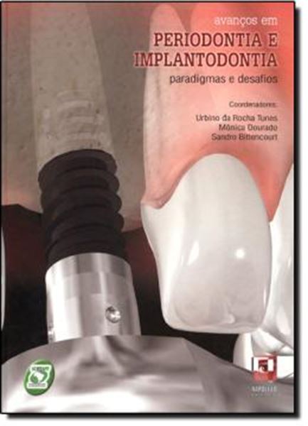 Picture of AVANCOS EM PERIODONTIA E IMPLANTODONTIA - PARADIGMAS E DESAFIOS