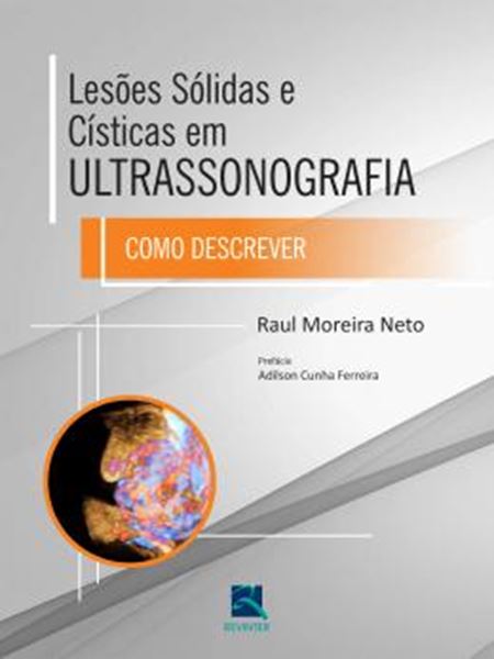 Picture of LESOES SOLIDAS E CISTICAS EM ULTRASSONOGRAFIA - COMO DESCREVER