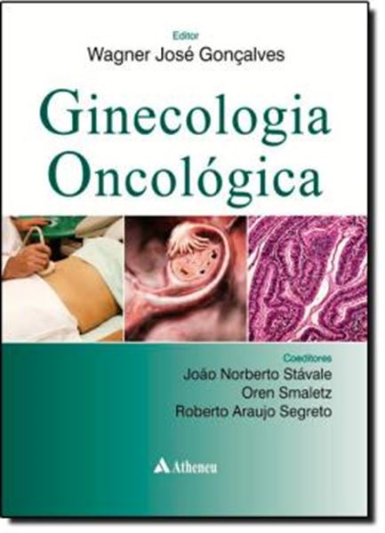 Picture of GINECOLOGIA ONCOLOGICA