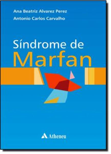 Picture of SINDROME DE MARFAN