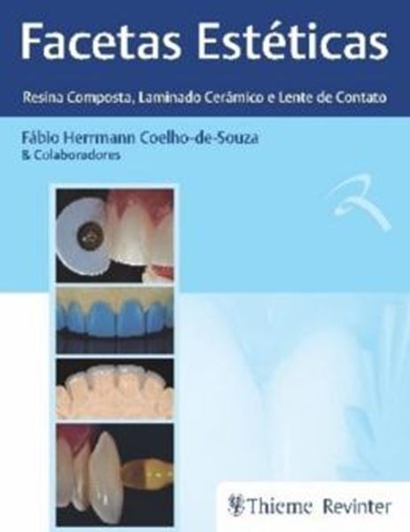 Picture of FACETAS ESTETICAS - RESINA COMPOSTA, LAMINADO CERAMICO E LENTE DE CONTATO