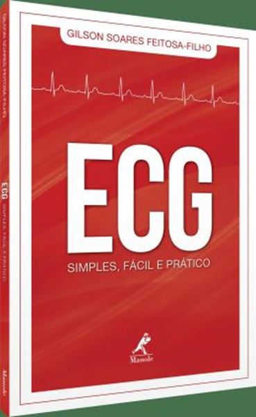 Picture of ECG SIMPLES, FACIL E PRATICO