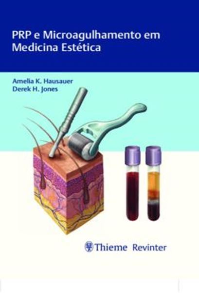 Picture of PRP E MICROAGULHAMENTO EM MEDICINA ESTETICA