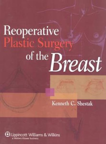 Picture of REOPERATIVE PLASTIC SURGERY OF THE BREAST