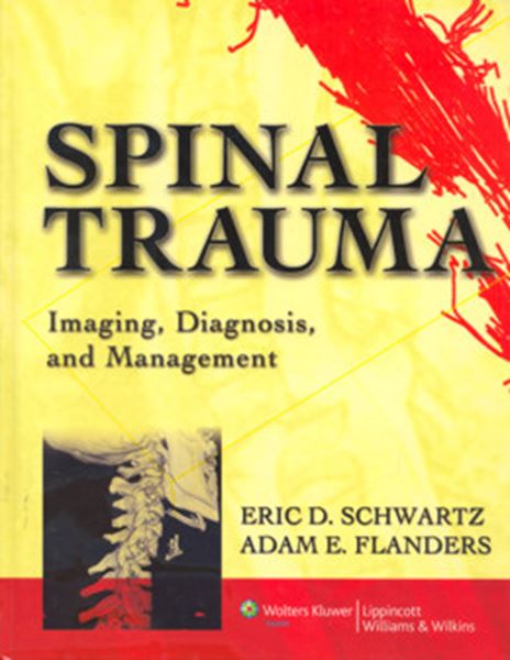 Picture of SPINAL TRAUMA - IMAGING, DIAGNOSIS, AND MANAGEMENT