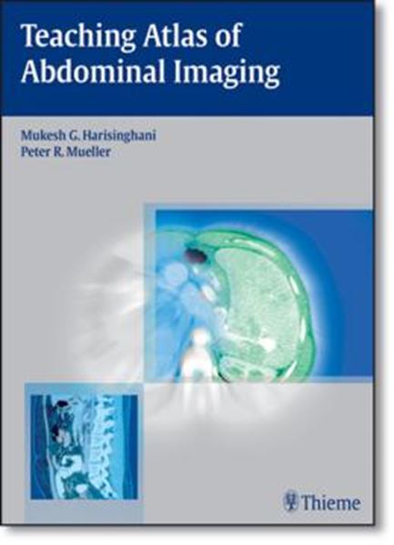 Picture of TEACHING ATLAS OF ABDOMINAL IMAGING