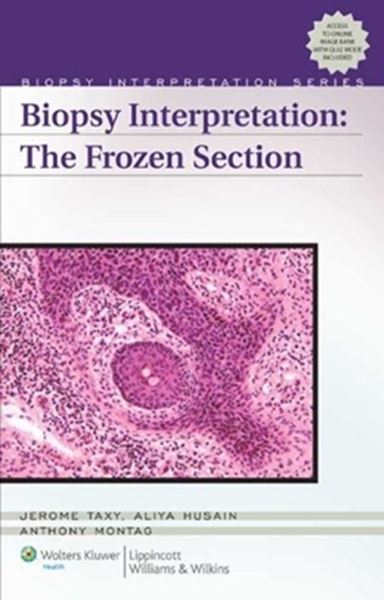 Picture of BIOPSY INTERPRETATION FROZEN