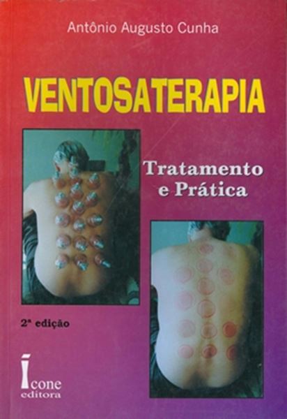 Picture of VENTOSATERAPIA   TRATAMENTO E PRATICA 