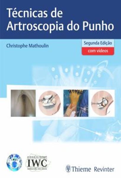 Picture of TECNICAS DE ARTROSCOPIA DO PUNHO