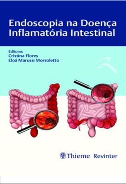 Picture of ENDOSCOPIA NA DOENCA INFLAMATORIA INTESTINAL