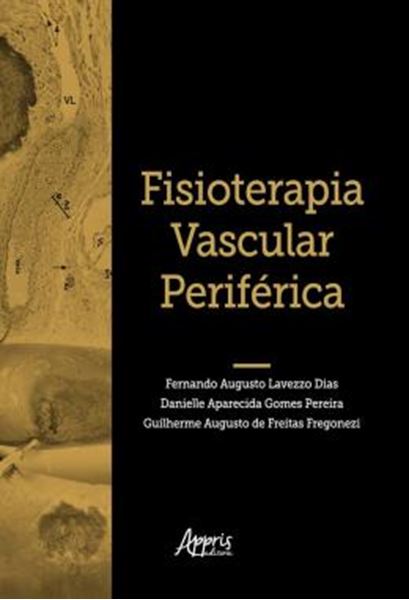 Picture of FISIOTERAPIA VASCULAR PERIFERICA