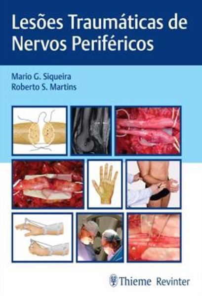 Picture of LESOES TRAUMATICAS DE NERVOS PERIFERICOS