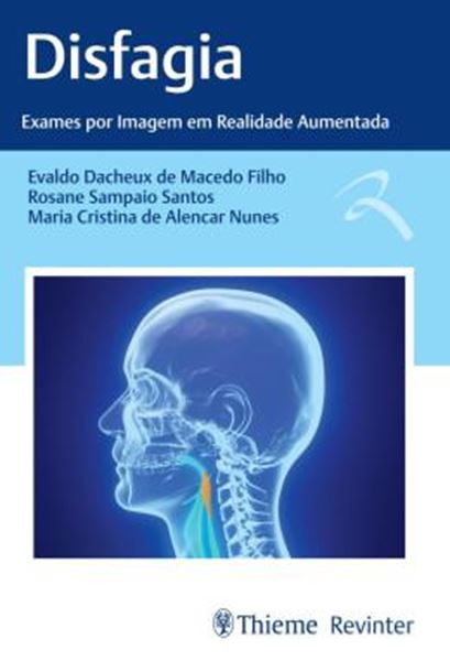 Picture of DISFAGIA - EXAMES POR IMAGEM EM REALIDADE AUMENTADA