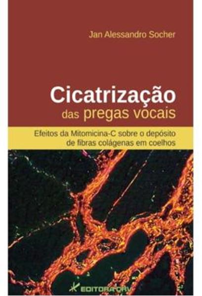 Picture of CICATRIZACAO DAS PREGAS VOCAIS - EFEITOS DA MITOMICINA-C SOBRE O DEPOSITO DE FIBRAS COLAGENAS EM COELHO