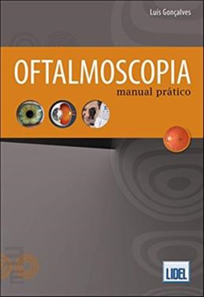 Picture of OFTALMOSCOPIA - MANUAL PRATICO