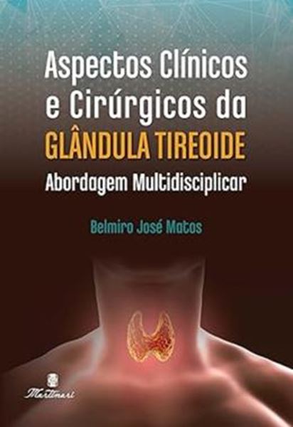 Picture of ASPECTOS CLINICOS E CIRURGICOS DA GLANDULA TIREOIDE: ABORDAGEM MULTIDISCIPLINAR