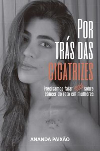 Picture of POR TRAS DAS CICATRIZES - PRECISAMOS FALAR SOBRE O CANCER DE RETO EM MULHERES