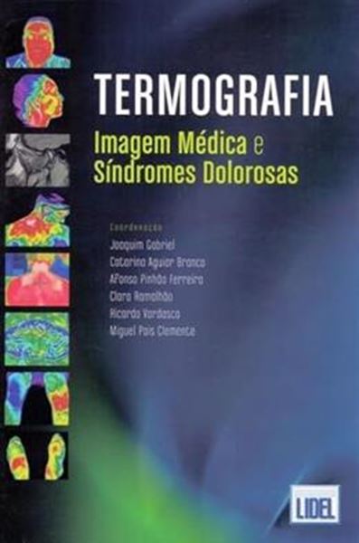 Picture of TERMOGRAFIA. IMAGEM MEDICA E SINDROMES DOLOROSAS