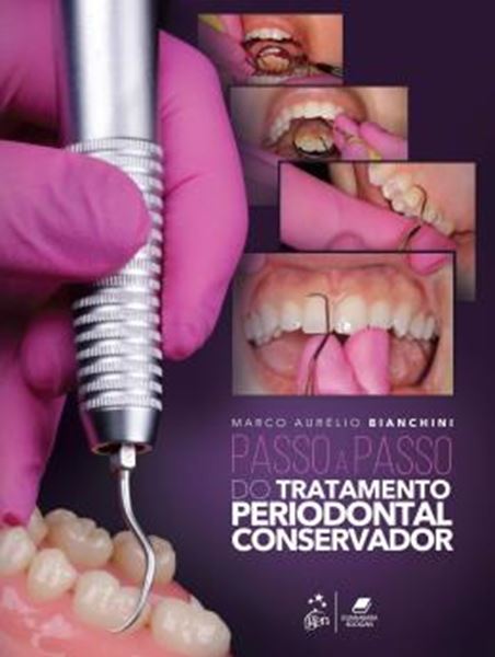 Picture of PASSO A PASSO DO TRATAMENTO PERIODONTAL CONSERVADOR